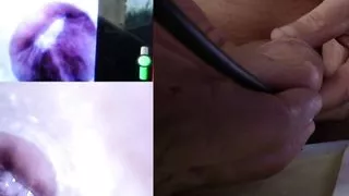 camera endoscopy of my cock