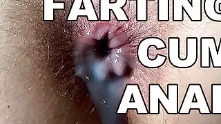 Farting Cum Anal. Squirting Hairy Anal Orgasm. Fart Asshole Close Up Creampie.